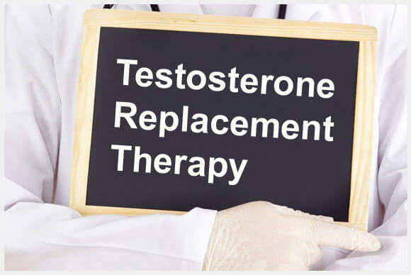 Benefits of Testosterone Replacement Therapy