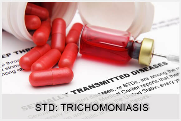Trichomoniasis Symptoms in Men and Women