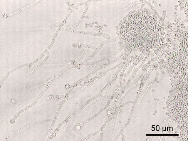 Candida, Vaginal yeast infection