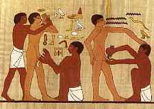 Circumcision Complications