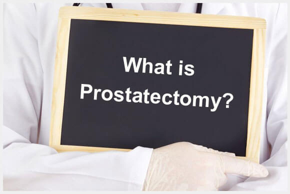 What is Prostatectomy? Explained by Dr. Elist