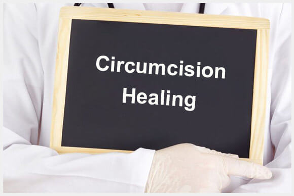 Circumcision Healing