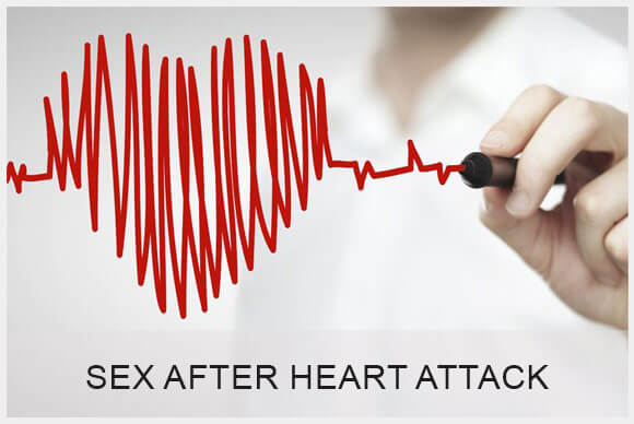 Sex After Heart Attack? Are you Ready for this?