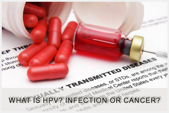 What is HPV? Human Papillomavirus, Infection or Cancer?