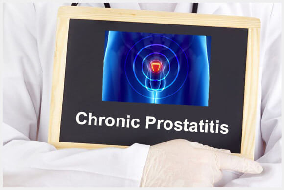 Chronic Bacterial Prostatitis