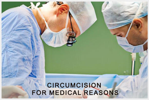 Reasons for Circumcision | Medical Obligations