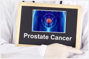 Dr. Elist Blog, Prostate Cancer