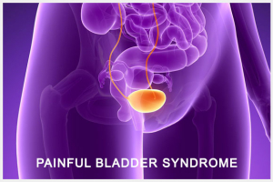 Shy Bladder Syndrome Image
