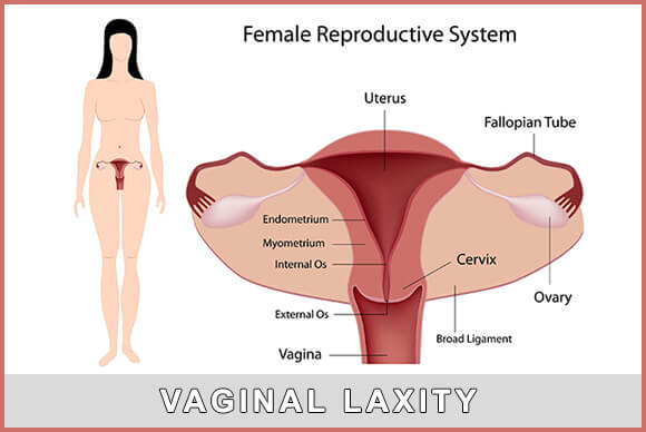 Vagina | Vaginal Laxity