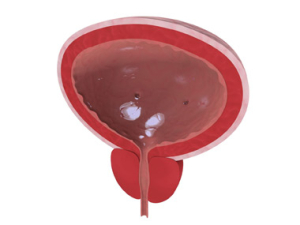 Bladder Voiding image