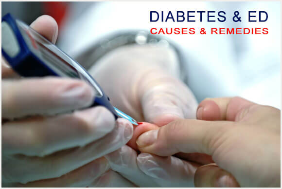Diabetes & ED | Causes | Remedies