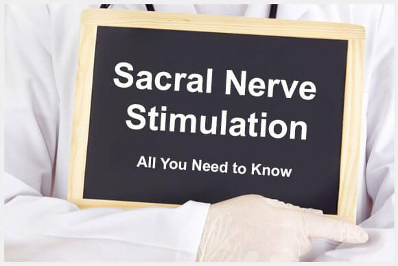 Sacral Nerve Stimulation