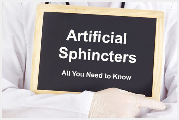 Artificial Sphincters | Expectations | Complications