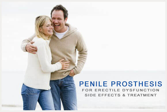Side Effects of Penile Prosthesis for Erectile Dysfunction