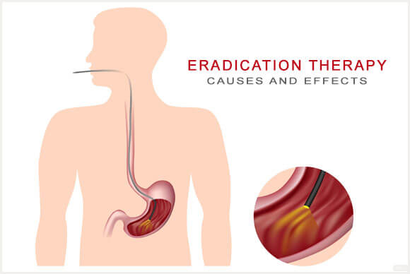 Eradication Therapy