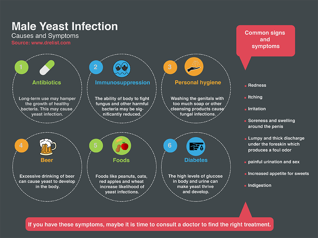 Yeast Infection Causes & Symptoms, Prevention