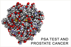 psa test Image