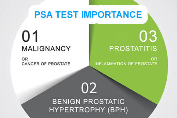 PSA Test Importance | Prostate Health Awareness Month