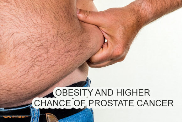 Obesity | A Higher Chance of Prostate Cancer