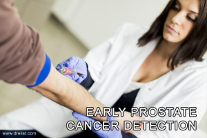 Early Prostate Cancer Detection Image