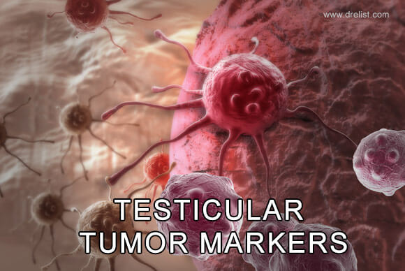 Testicular Tumor Markers