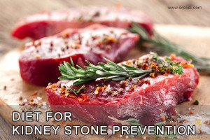 Diet for Kidney Stone Prevention Image