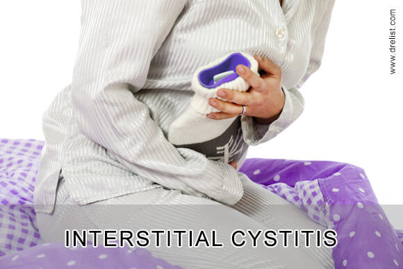 Interstitial Cystitis Symptoms | Treatment