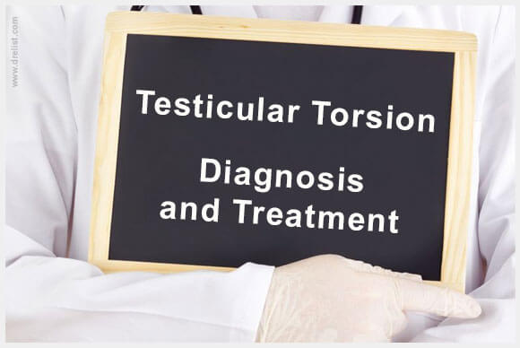 Testicular Torsion: Diagnosis and Treatment