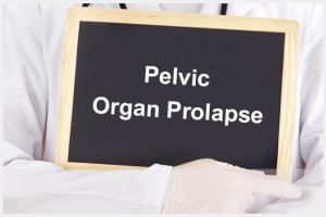 Pelvic Organ Prolapse