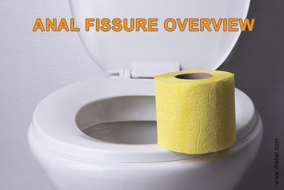 Anal Fissure Overview