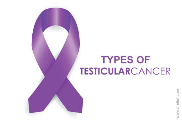 Testicular Cancer Types