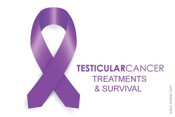 Testicular Cancer Treatments and Survival