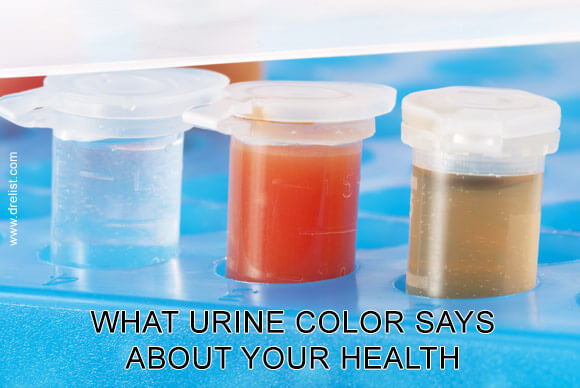 What Urine Color Says About Your Health