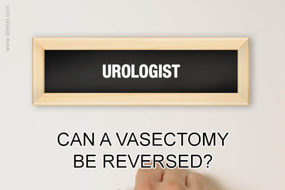 Can a Vasectomy Be Reversed?