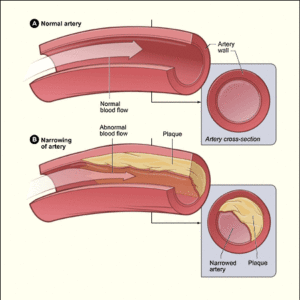 Erectile Dysfunction Image