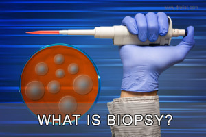 What Is Biopsy Image