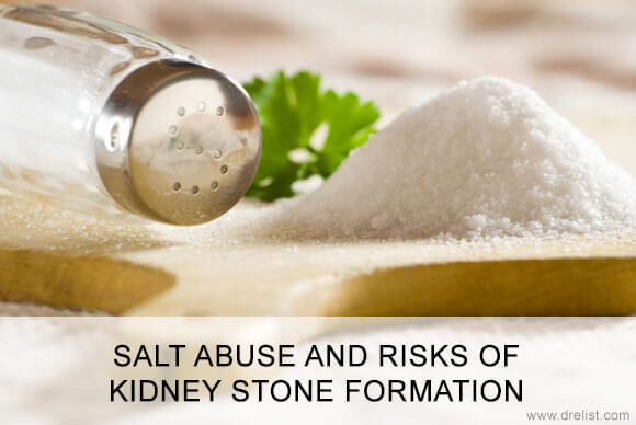 Role of Salt Abuse on the Risk for Kidney Stone Formation