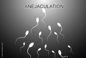 Anejaculation Image