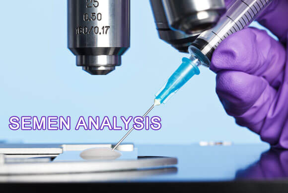 Semen Analysis