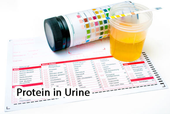 Protein in Urine