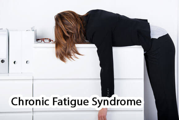 Chronic Fatigue Syndrome