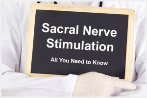 Sacral Nerve Stimulation Image