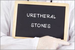 Urethral Stones Info.