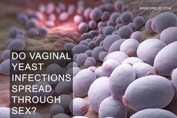 Do Vaginal Yeast Infections Spread Through Sex?