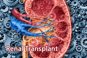 Renal Transplant Image