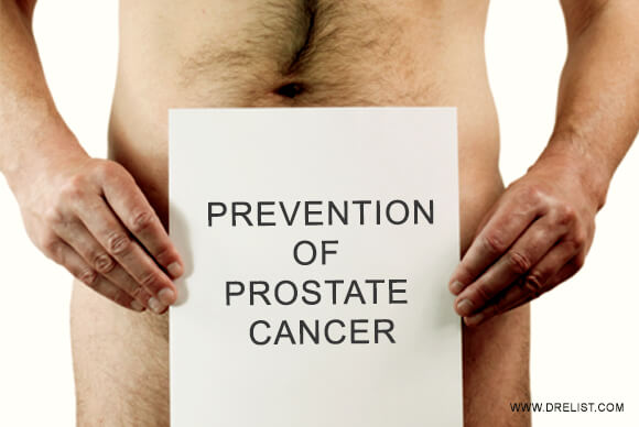 Prevention of Prostate Cancer
