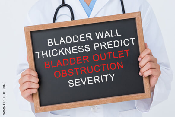 Bladder Wall Thickness May Predict Bladder Outlet Obstruction (BOO) Severity