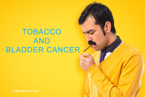 A Leading Urologist Talks About Tobacco and Bladder Cancer