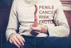 Penile Cancer Risk Factors image