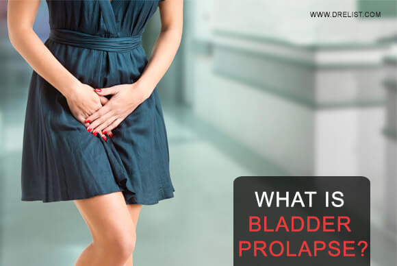 What is bladder prolapse?